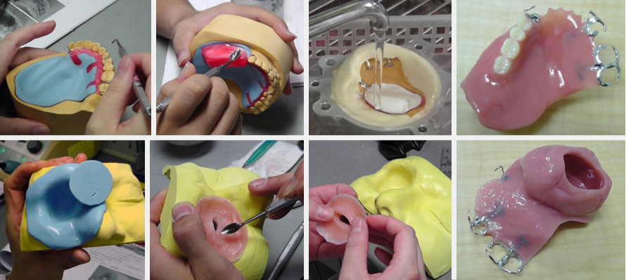顎補綴工学実習