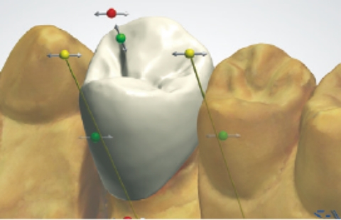 歯冠修復工学実習・審美修復工学実習・CAD/CAMシステム工学実習・演習