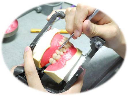 歯科技工士が活躍するフィールド
