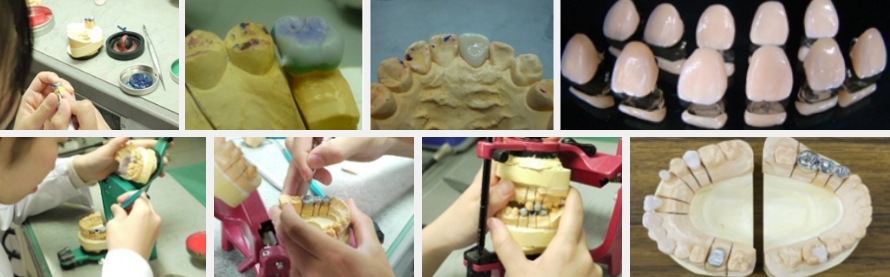 歯冠修復学・実習