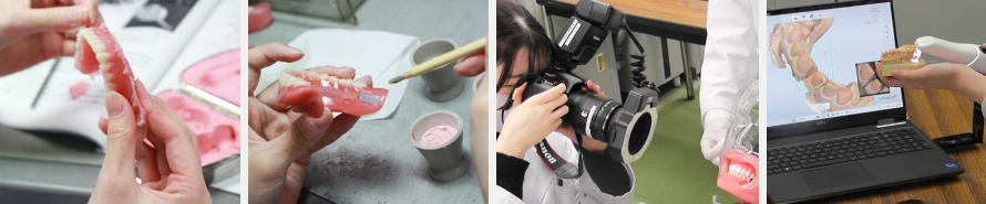 臨床義歯管理工学