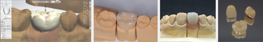 審美修復学実習