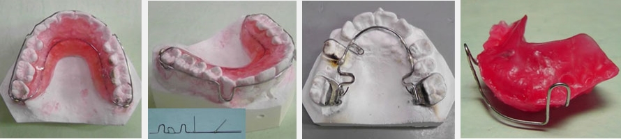 矯正歯科工学